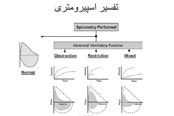 آشنایی با تست های اسپیرومتری و ادیومتری در معاینات سلامت شغلی