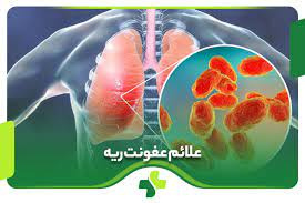 درباره عفونت ریه بیشتر بدانید